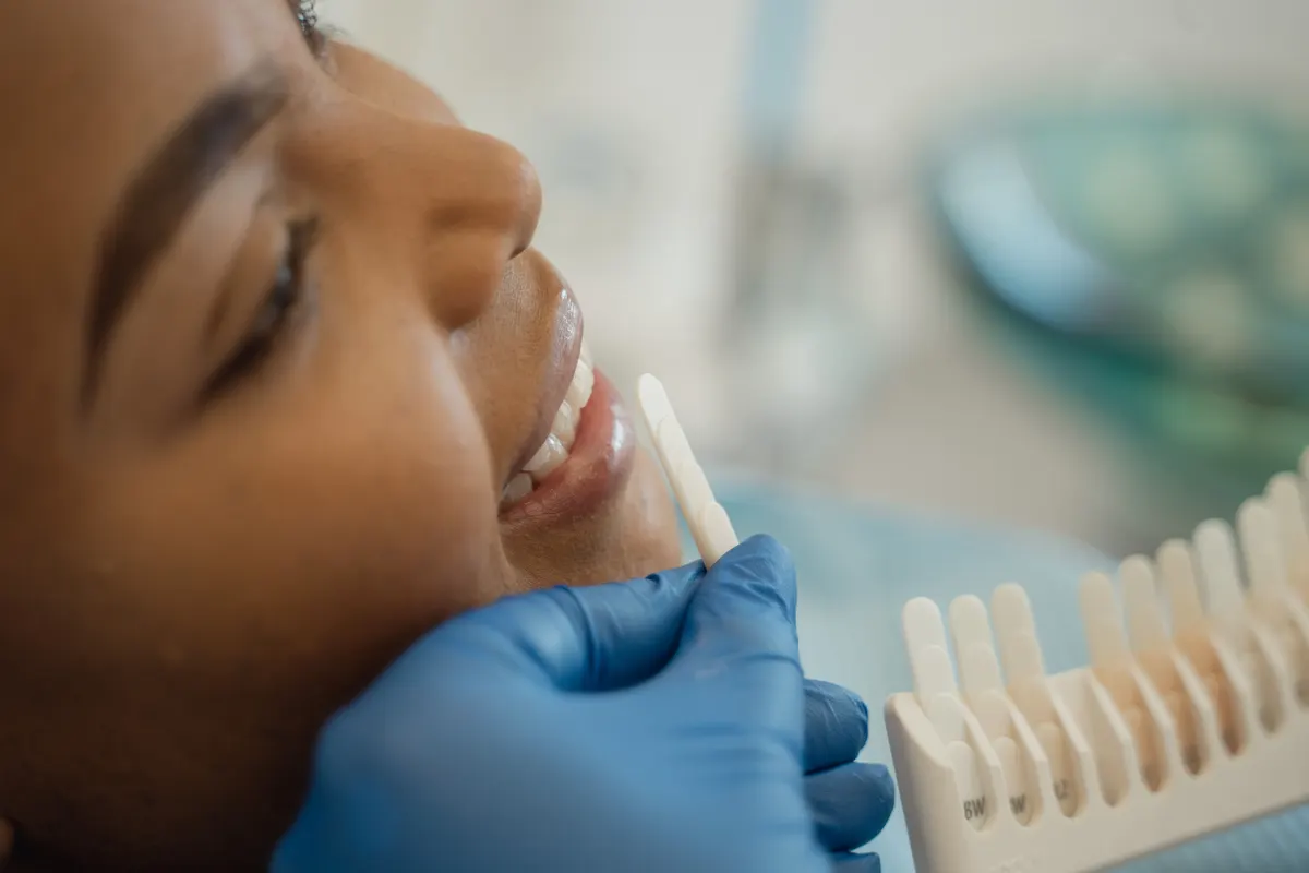 A tooth shade guide held up against a patient's smile.