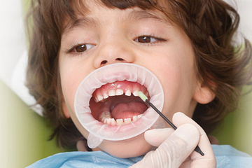 Child Fluoride Therapy Islamabad