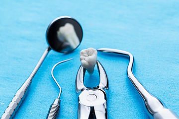 Dental Extractions in Islamabad