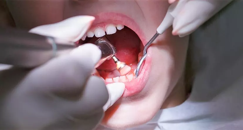 pedodontics dental service